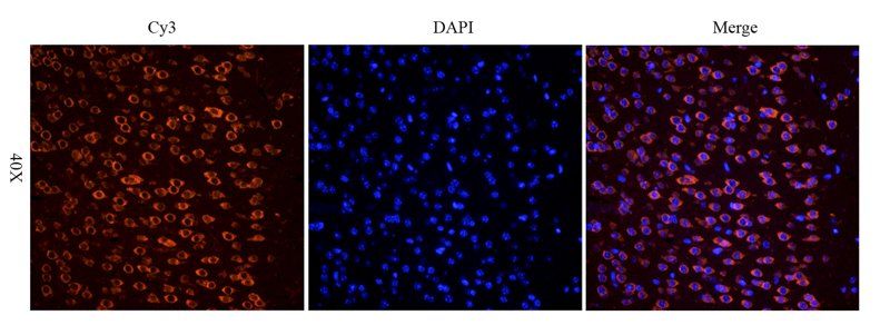 Apelin antibody