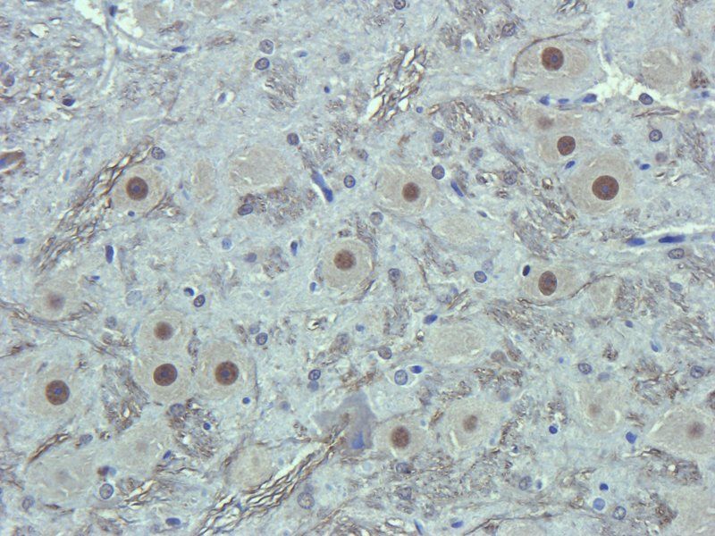 Apelin antibody