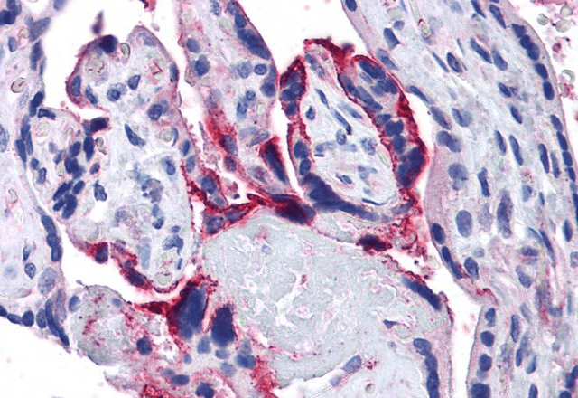 Goat anti-APH1A Antibody