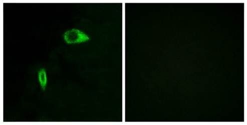 API-5 antibody