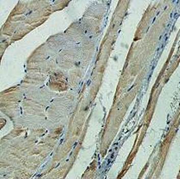 APIP Rabbit Polyclonal Antibody