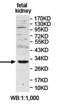 APIP Rabbit Polyclonal Antibody