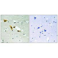 APLF (Ab-116) Antibody