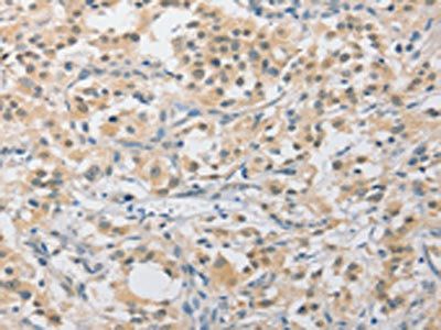 APLF Antibody