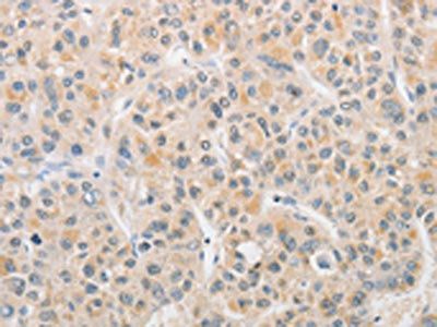 APLF Antibody