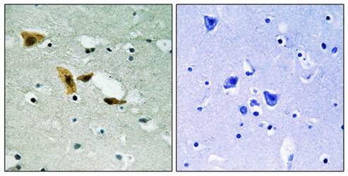 APLF (Ab-116) Antibody