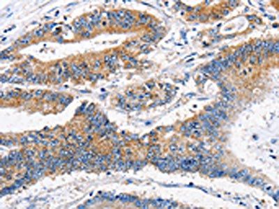 APLNR Antibody