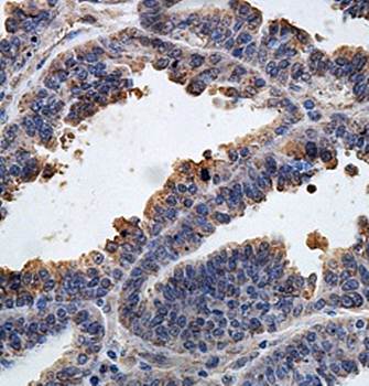 APLNR Rabbit Polyclonal Antibody