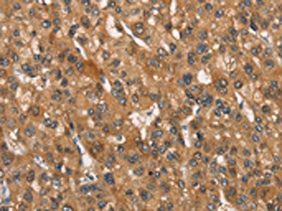 APOA1BP Antibody