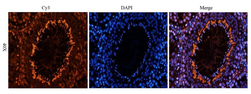 APOBEC3B antibody