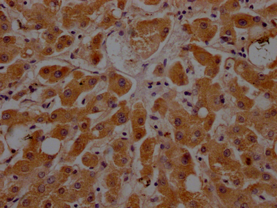APOC3 Recombinant Monoclonal Antibody