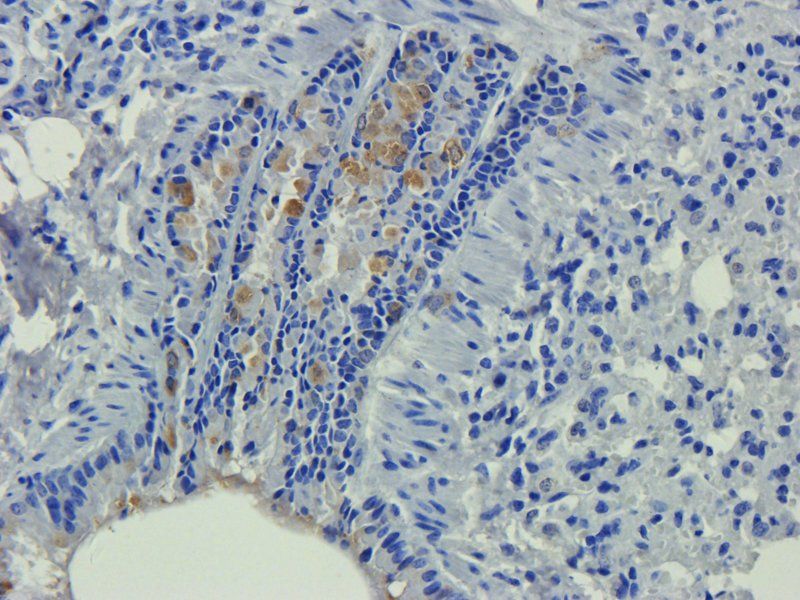 Apolipoprotein E antibody