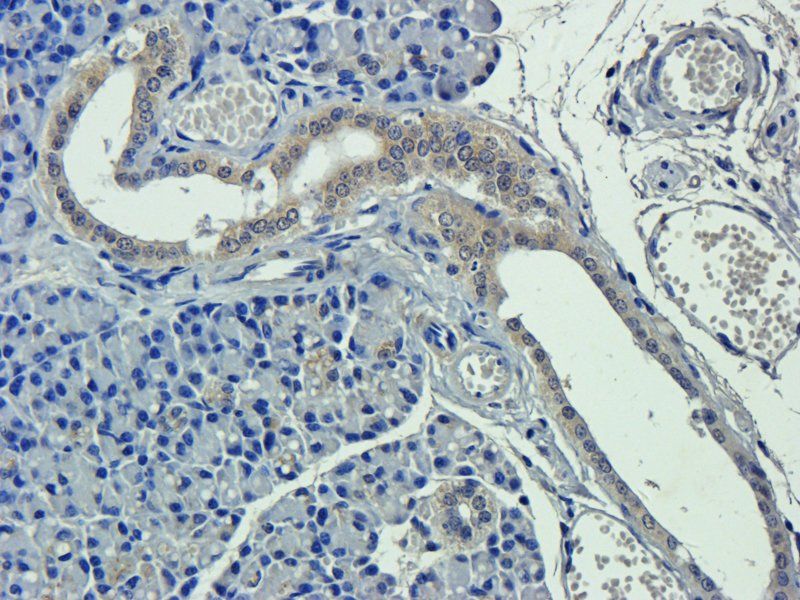 Apolipoprotein E antibody