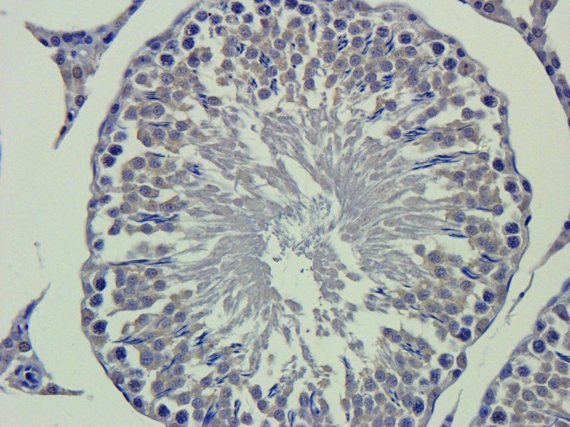 Apolipoprotein E antibody