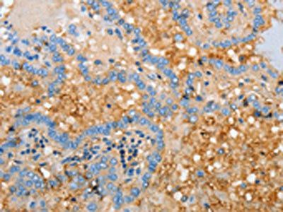 APOH Antibody