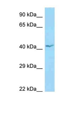 APOL1 antibody