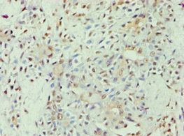 APOL1 antibody