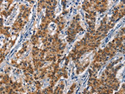APOL1 Antibody