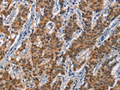 APOL1 antibody