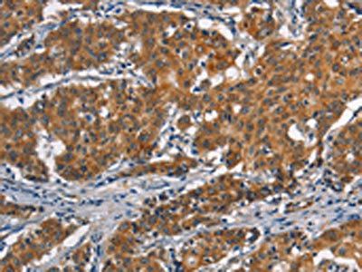 APOL1 Antibody