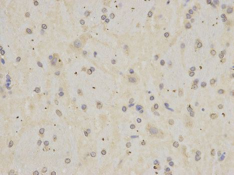 APOH Rabbit Polyclonal Antibody