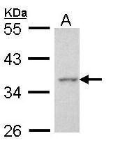 Apoptosis-enhancing nuclease antibody [C2C3], C-term