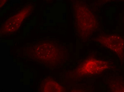 APP Antibody