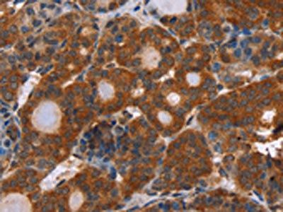 APP Antibody