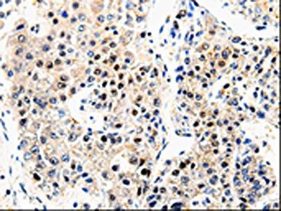 APP Antibody