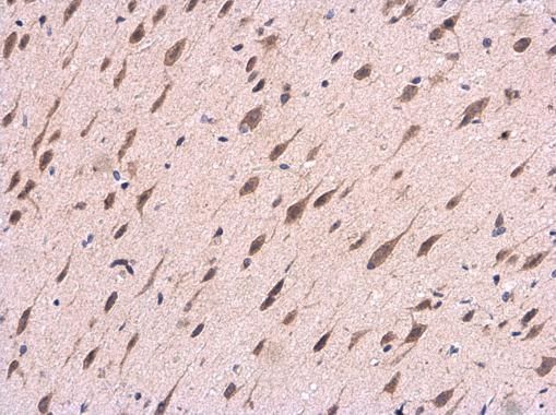 APP antibody [C2C3], C-term