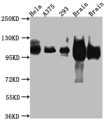 APP antibody