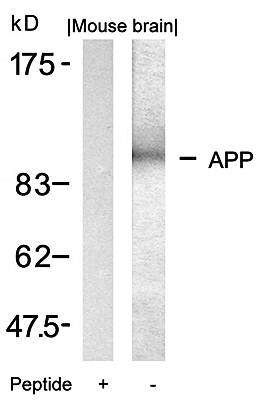 APP Rabbit Polyclonal Antibody