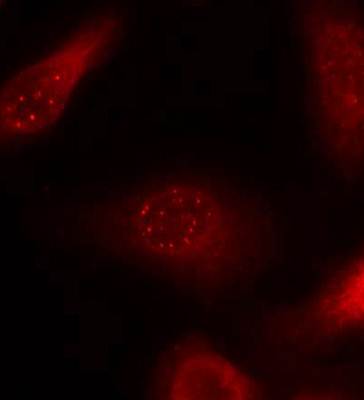 APP Rabbit Polyclonal Antibody