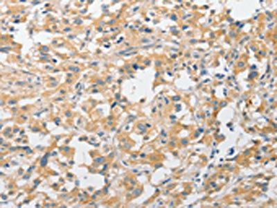 APPBP2 Antibody