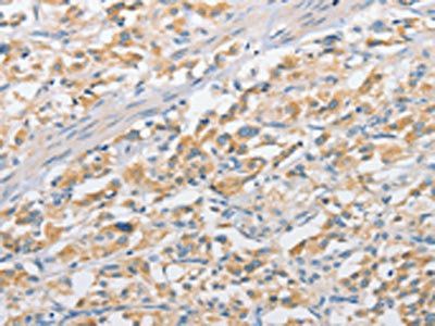APPBP2 Antibody