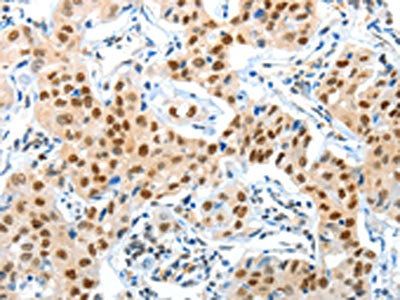 APPL1 Antibody