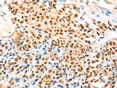 APPL1 Antibody