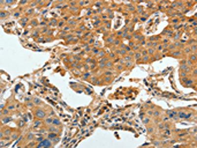 APPL1 Antibody