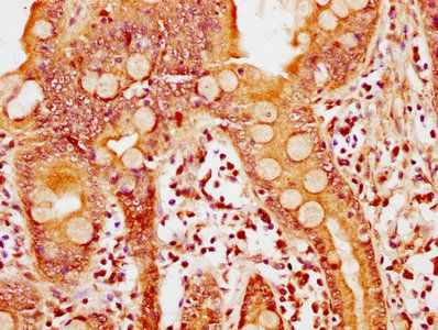 APPL2 Antibody