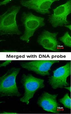 APRT Rabbit Polyclonal Antibody