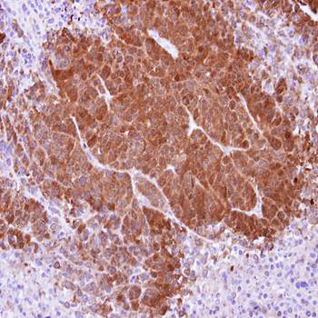 APRT Rabbit Polyclonal Antibody