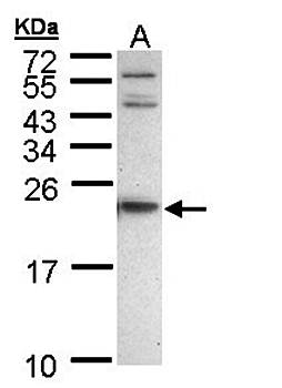 APRT Rabbit Polyclonal Antibody