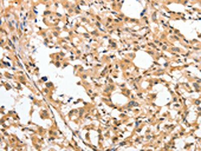 APTX Antibody