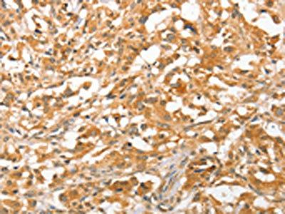 APTX Antibody