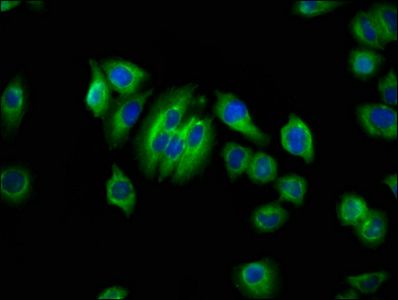 AQP10 antibody