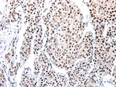 AQP2 Antibody