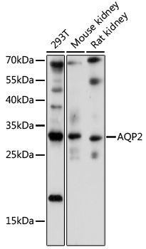 AQP2 antibody