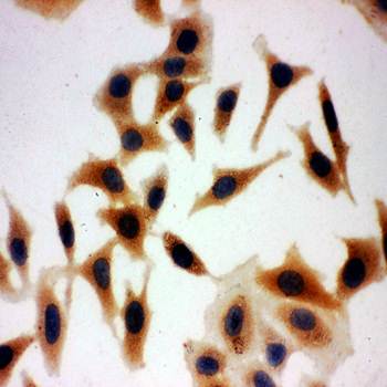 Anti-Aquaporin 3/AQP3 Antibody