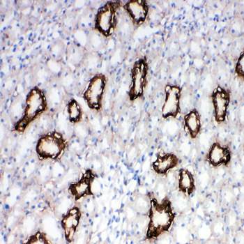 Anti-Aquaporin 3/AQP3 Antibody