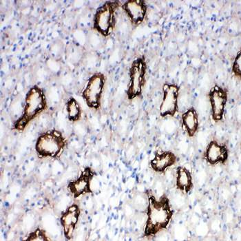 Aquaporin 3/AQP3 Antibody